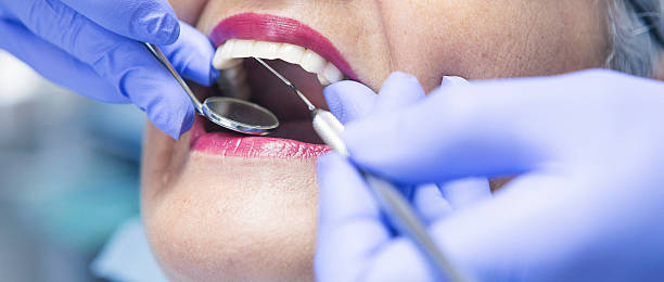 Best Emergency Wisdom Tooth Extraction in Hays, NC