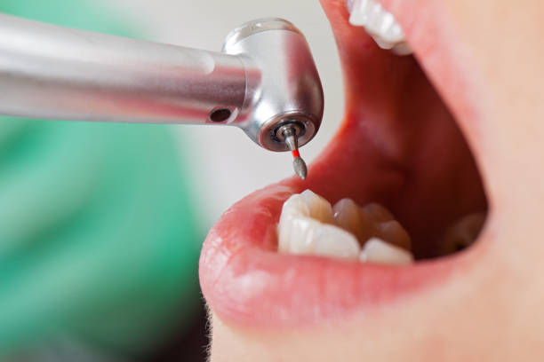 Best Emergency Denture Repair in Hays, NC
